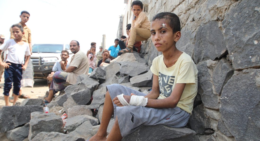 Alaa Mokbel, 13, was injured by an unexploded ordnance in Mokha, Yemen. Credit: Elsa Buchanan for Project Masam