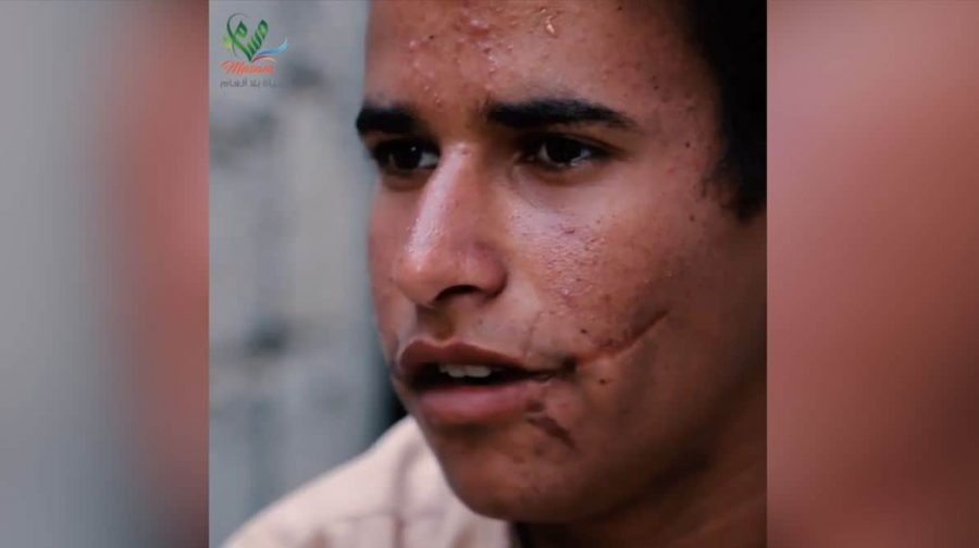 تشوهات