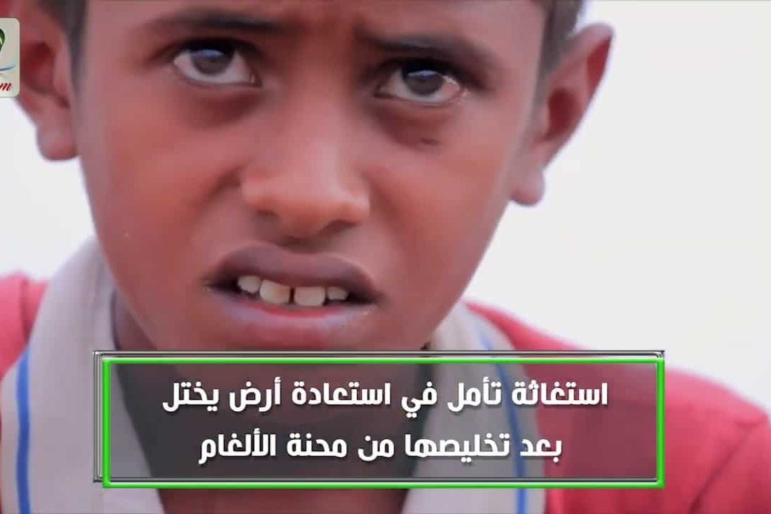 علي عبدالله.. ضحية لغم حوثي فتك بطفولته