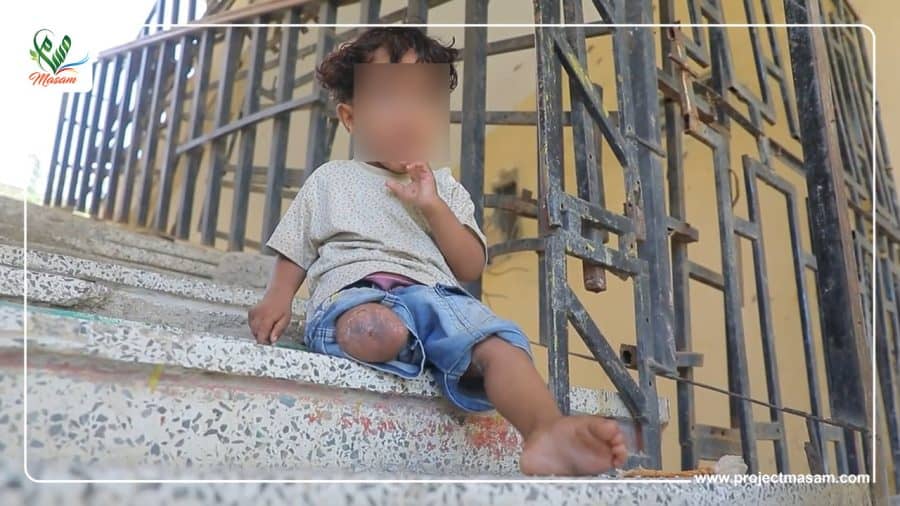 جنيف.. معرض يكشف صور لضحايا الألغام الحوثية جنيف.. معرض يكشف صور لضحايا الألغام الحوثية