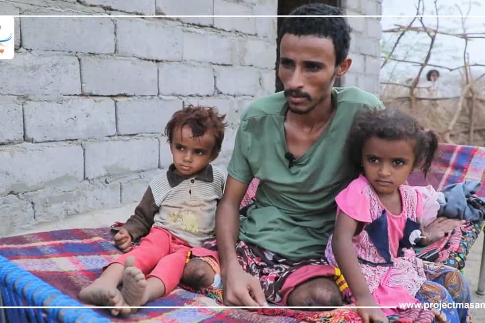 خدام علي.. مأساة أب يمني