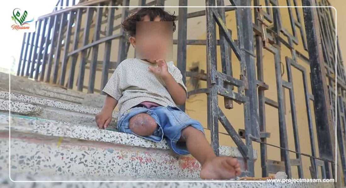 قذيفة حوثية تحصد روحين وساق طفل من أسرة واحدة